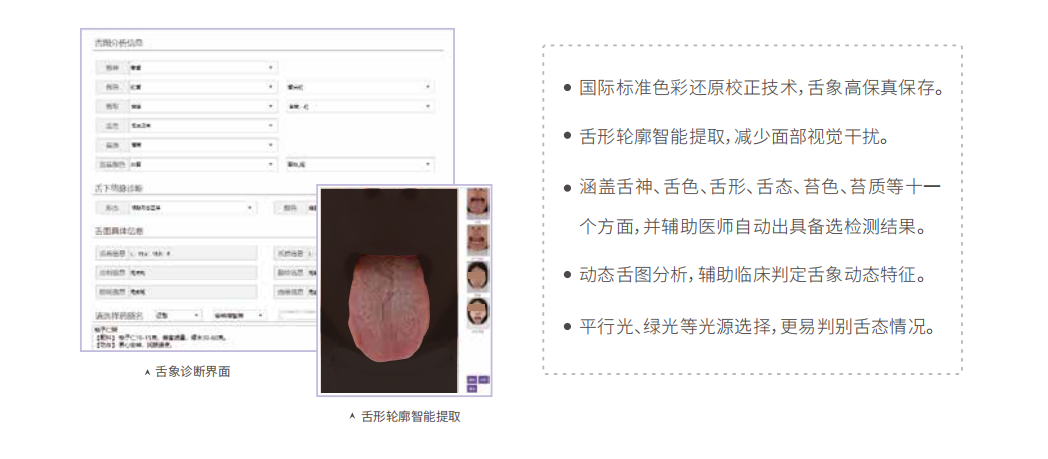 中医舌诊仪（舌象信息采集管理系统）舌象分析